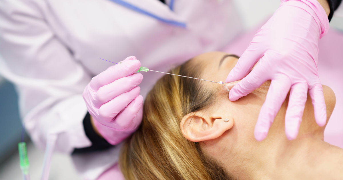 Woman receiving PDO Glow Max thread lift on face by doctor in Salt Lake City, UT